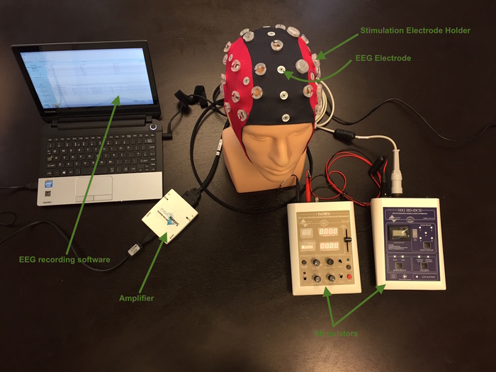 HD-tES+EEG setup.JPG
