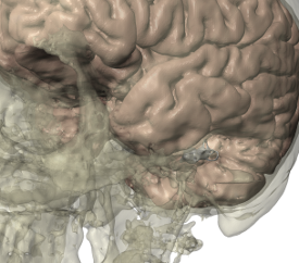 vestibular-about1.png