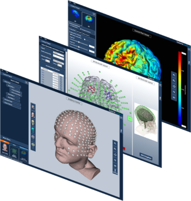 HD-Explore电流/电场解析系统